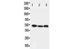 Anti-Beclin 1 antibody, Western blotting Lane 1: HELA Cell Lysate Lane 2: SW620 Cell Lysate Lane 3: PANC Cell Lysate (Beclin 1 抗体  (Middle Region))