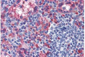 Human Spleen: Formalin-Fixed, Paraffin-Embedded (FFPE) (TXNIP 抗体  (C-Term))