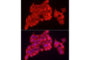 Immunofluorescence analysis of HeLa cells using INPP5K Rabbit pAb (ABIN6132112, ABIN6142473, ABIN6142474 and ABIN6223771) at dilution of 1:150 (40x lens). (INPP5K 抗体  (AA 149-448))