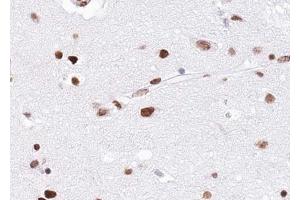ABIN6268797 at 1/100 staining human brain tissue sections by IHC-P. (EZH1 抗体  (Internal Region))