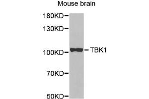 Western blot analysis of extracts of mouse brain, using TBK1 antibody. (TBK1 抗体)