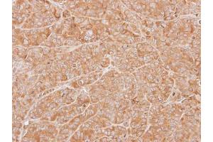 Immunohistochemistry (IHC) image for anti-Zinc Finger, HIT-Type Containing 1 (ZNHIT1) antibody (ABIN2855262)