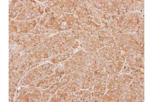 IHC-P Image Immunohistochemical analysis of paraffin-embedded SW480 xenograft, using ZNHIT1, antibody at 1:500 dilution. (ZNHIT1 抗体)