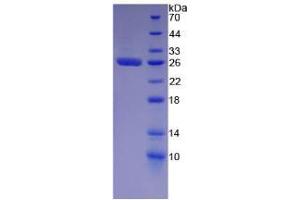 SDS-PAGE analysis of Human GSTa2 Protein. (GSTa2 蛋白)