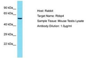 Image no. 1 for anti-Retinoblastoma Binding Protein 4 (RBBP4) (C-Term) antibody (ABIN6750365) (Retinoblastoma Binding Protein 4 抗体  (C-Term))
