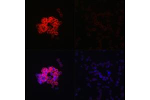 Immunofluorescence analysis of THP-1 treated with LPS(32h) and THP-1 cells using IFIH1 Rabbit pAb (ABIN6131879, ABIN6142174, ABIN6142175 and ABIN6217724) at dilution of 1:100 (40x lens).