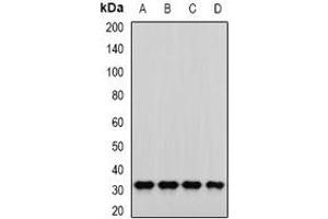 Western blot analysis of PNP expression in SKOV3 (A), MCF7 (B), mouse liver (C), mouse kidney (D) whole cell lysates. (PNP 抗体)