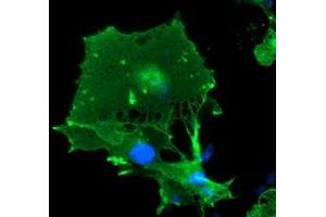 Anti-LIMK1 mouse monoclonal antibody (ABIN2454653) immunofluorescent staining of COS7 cells transiently transfected by pCMV6-ENTRY LIMK1 (RC218058). (LIM Domain Kinase 1 抗体)