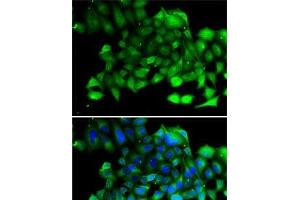 Immunofluorescence analysis of A-549 cells using CLIC4 Polyclonal Antibody (CLIC4 抗体)