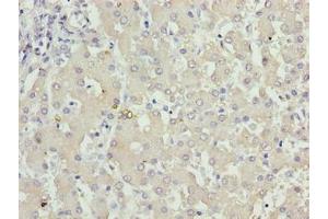Immunohistochemistry of paraffin-embedded human liver tissue using ABIN7157483 at dilution of 1:100 (KHDC1 抗体  (AA 74-237))