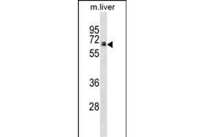Rat Ggt1 Antibody (N-term) (ABIN1881372 and ABIN2838691) western blot analysis in mouse liver tissue lysates (35 μg/lane). (GGT1 抗体  (N-Term))