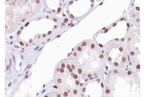 ABIN6267388 at 1/100 staining human Kidney tissue sections by IHC-P. (ATF2 抗体  (pSer94, pSer112))