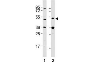 Western blot testing of LAG3 antibody at 1:2000 dilution tested on lysates from Lane 1: 293T; 2: human spleen; Predicted molecular weight ~54 kDa. (LAG3 抗体  (AA 103-132))