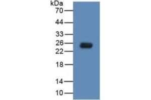 WB of Protein Standard: different control antibodies  against Highly purified E. (TLR5 ELISA 试剂盒)