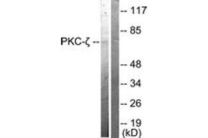 Western blot analysis of extracts from NIH-3T3 cells, treated with PMA 125ng/ml 30', using PKC zeta (Ab-410) Antibody. (PKC zeta 抗体  (AA 376-425))