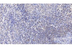 Immunohistochemistry (IHC) image for anti-PSME3 (PSME3) (AA 7-254) antibody (ABIN7441328)