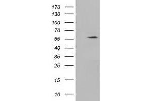 Western Blotting (WB) image for anti-Kelch-Like 2, Mayven (KLHL2) (AA 1-100), (AA 494-593) antibody (ABIN1490548) (KLHL2 抗体  (AA 1-100, AA 494-593))