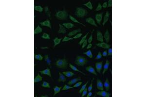Immunofluorescence (IF) image for anti-Bone Morphogenetic Protein Receptor, Type IB (BMPR1B) (AA 1-126) antibody (ABIN3022720)