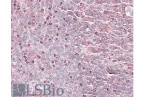 ABIN570940 (3. (Septin 6 抗体  (Internal Region))