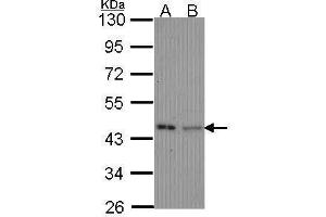 WB Image Sample (30 ug of whole cell lysate) A: Hela B: JurKat 10% SDS PAGE antibody diluted at 1:1000