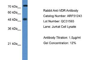 WB Suggested Anti-VDR Antibody   Titration: 1. (Vitamin D Receptor 抗体  (N-Term))