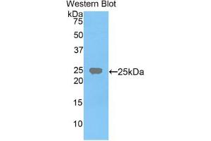 Western blot analysis of the recombinant protein. (FDFT1 抗体  (AA 217-416))