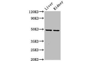 Western Blot Positive WB detected in: Rat liver tissue, Rat kidney tissue All lanes: DLST antibody at 5.