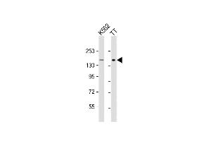 All lanes : Anti-c-KIT Antibody (C-term) at 1:1000 dilution Lane 1: K562 whole cell lysate Lane 2: TT whole cell lysate Lysates/proteins at 20 μg per lane. (KIT 抗体  (AA 912-941))