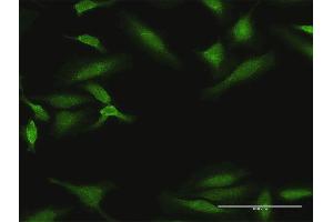 Immunofluorescence of purified MaxPab antibody to DYRK1B on HeLa cell. (DYRK1B 抗体  (AA 1-629))