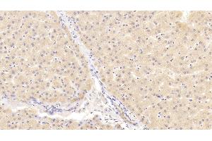 Detection of NOTCH2 in Human Liver Tissue using Polyclonal Antibody to Notch Homolog 2 (NOTCH2) (NOTCH2 抗体  (AA 2251-2466))