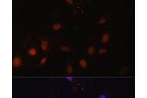 Immunofluorescence analysis of U-2 OS cells using SNW1 Polyclonal Antibody at dilution of 1:100. (SNW1 抗体)