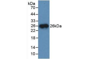 Detection of Recombinant CTSB, Mouse using Polyclonal Antibody to Cathepsin B (CTSB) (Cathepsin B 抗体  (AA 129-333))