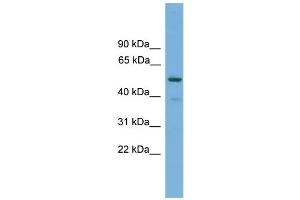 WB Suggested Anti-TRIM38 Antibody Titration: 0. (TRIM38 抗体  (Middle Region))
