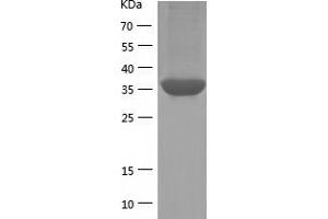 Western Blotting (WB) image for Protein Phosphatase 1, Regulatory Subunit 8 (PPP1R8) (AA 1-351) protein (His tag) (ABIN7124669) (PPP1R8 Protein (AA 1-351) (His tag))