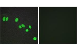 Immunofluorescence analysis of A549 cells, using NCOR2 Antibody. (NCOR2 抗体  (AA 511-560))