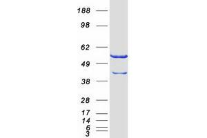 Western Blotting (WB) image for CAP, Adenylate Cyclase-Associated Protein 1 (CAP1) (Transcript Variant 1) protein (Myc-DYKDDDDK Tag) (ABIN2713108)