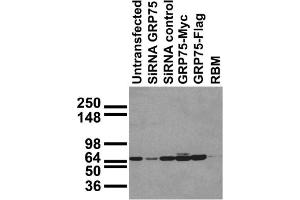 Immunoblot against HEK293 cells transfected as shown.