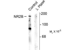 Image no. 1 for anti-Glutamate Receptor, Ionotropic, N-Methyl D-Aspartate 2B (GRIN2B) (pSer1480) antibody (ABIN372688) (GRIN2B 抗体  (pSer1480))