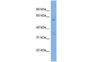 Ubiquilin 4 antibody used at 1 ug/ml to detect target protein. (UBQLN4 抗体  (Middle Region))