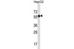 Western Blotting (WB) image for anti-Carboxypeptidase N Subunit 2 (CPN2) antibody (ABIN2997205) (CPN2 抗体)