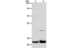 Western Blot analysis of Lovo and PC3 cell using MPG Polyclonal Antibody at dilution of 1:950 (MPG 抗体)