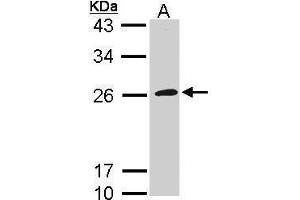 WB Image Sample (30 ug of whole cell lysate) A: Raji 12% SDS PAGE antibody diluted at 1:1000 (GP1BB 抗体  (Internal Region))