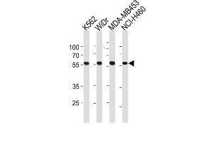 Western Blotting (WB) image for anti-Nuclear Pore Complex Interacting Protein-Like 2 (NPIPL2) antibody (ABIN3004718) (NPIPL2 抗体)
