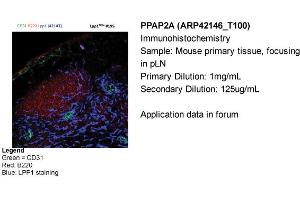 Immunohistochemistry (IHC) image for anti-Phosphatidic Acid Phosphatase Type 2A (PPAP2A) (Middle Region) antibody (ABIN2777163)