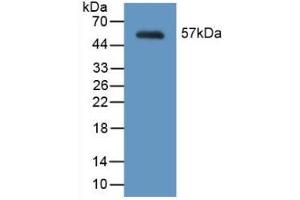 Detection of Recombinant MYH2, Mouse using Polyclonal Antibody to Myosin Heavy Chain 2 (MYH2) (MYH2 抗体  (AA 1238-1472))