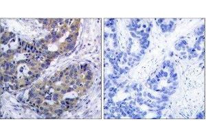 Immunohistochemistry (IHC) image for anti-Insulin Receptor Substrate 1 (IRS1) (Ser312) antibody (ABIN1848112) (IRS1 抗体  (Ser312))