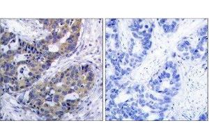 Immunohistochemistry (IHC) image for anti-Insulin Receptor Substrate 1 (IRS1) (Ser312) antibody (ABIN1848113) (IRS1 抗体  (Ser312))