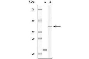 Western blot analysis using CIB1 mouse mAb against truncated CIB1 recombinant protein (1) and A431 cell lysate (2). (CIB1 抗体)