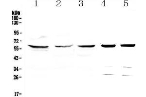 Western blot analysis of TCP1 eta using anti-TCP1 eta antibody . (CCT7 抗体  (AA 30-307))