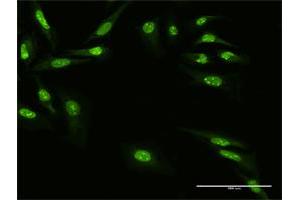 Immunofluorescence of purified MaxPab antibody to ZNF668 on HeLa cell. (ZNF668 抗体  (AA 1-619))